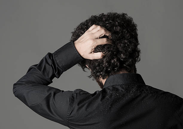 Man in a black shirt scratching his scalp, with visible dandruff on his shoulders.